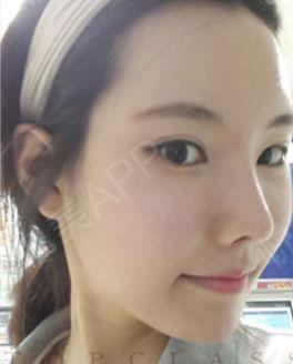 娛樂(lè )吃瓜醬不用做鼻子,揭秘明星隱私，不做鼻子也能暢游娛樂(lè )圈